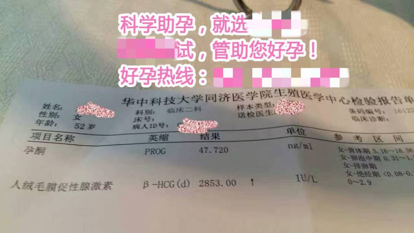 试管婴儿