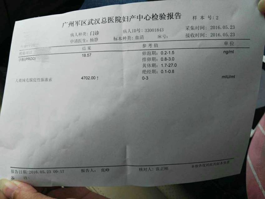 试管婴儿