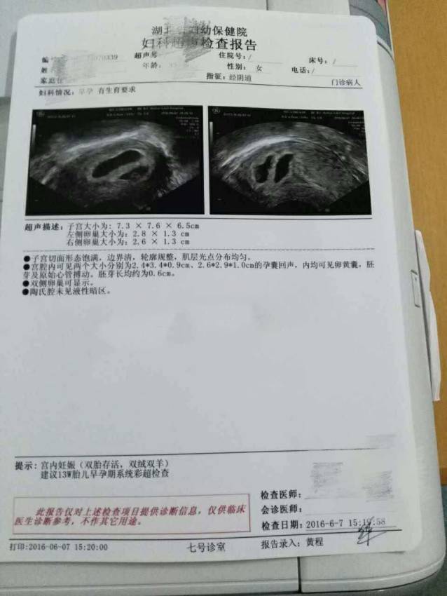 试管婴儿