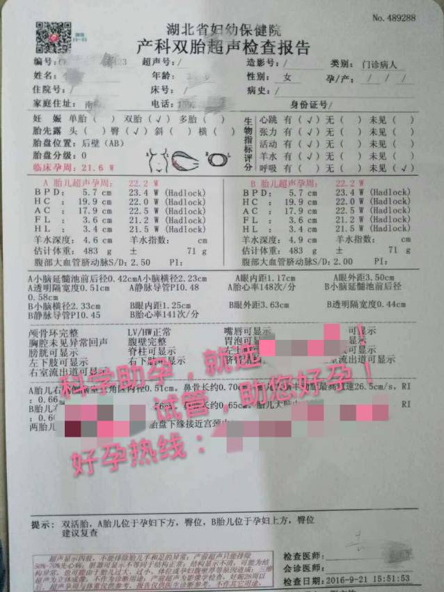 试管婴儿