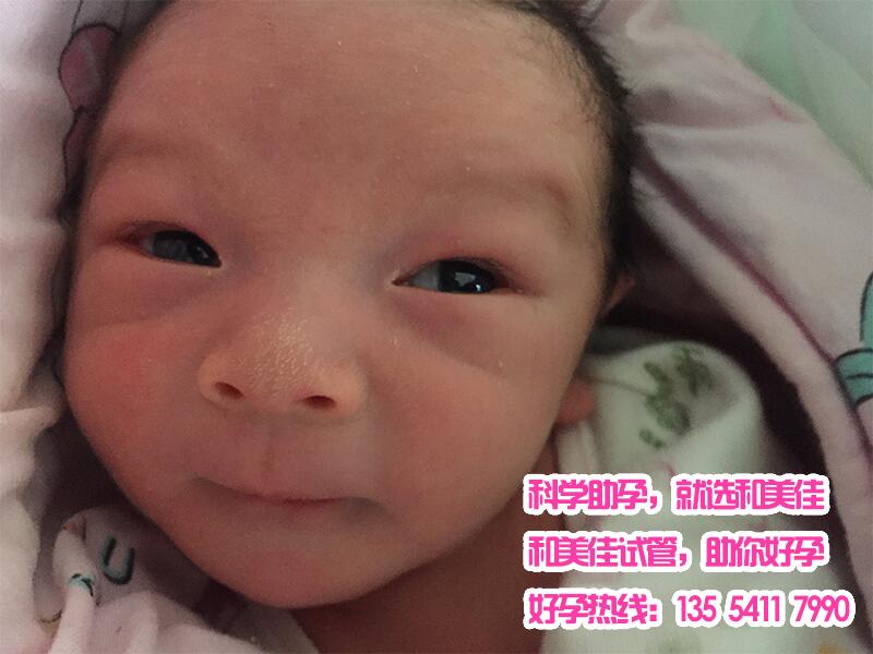 助孕