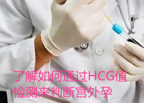 了解如何通过HCG值检测来判断宫外孕