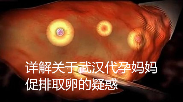 详解关于广州助孕妈妈促排取卵的疑惑